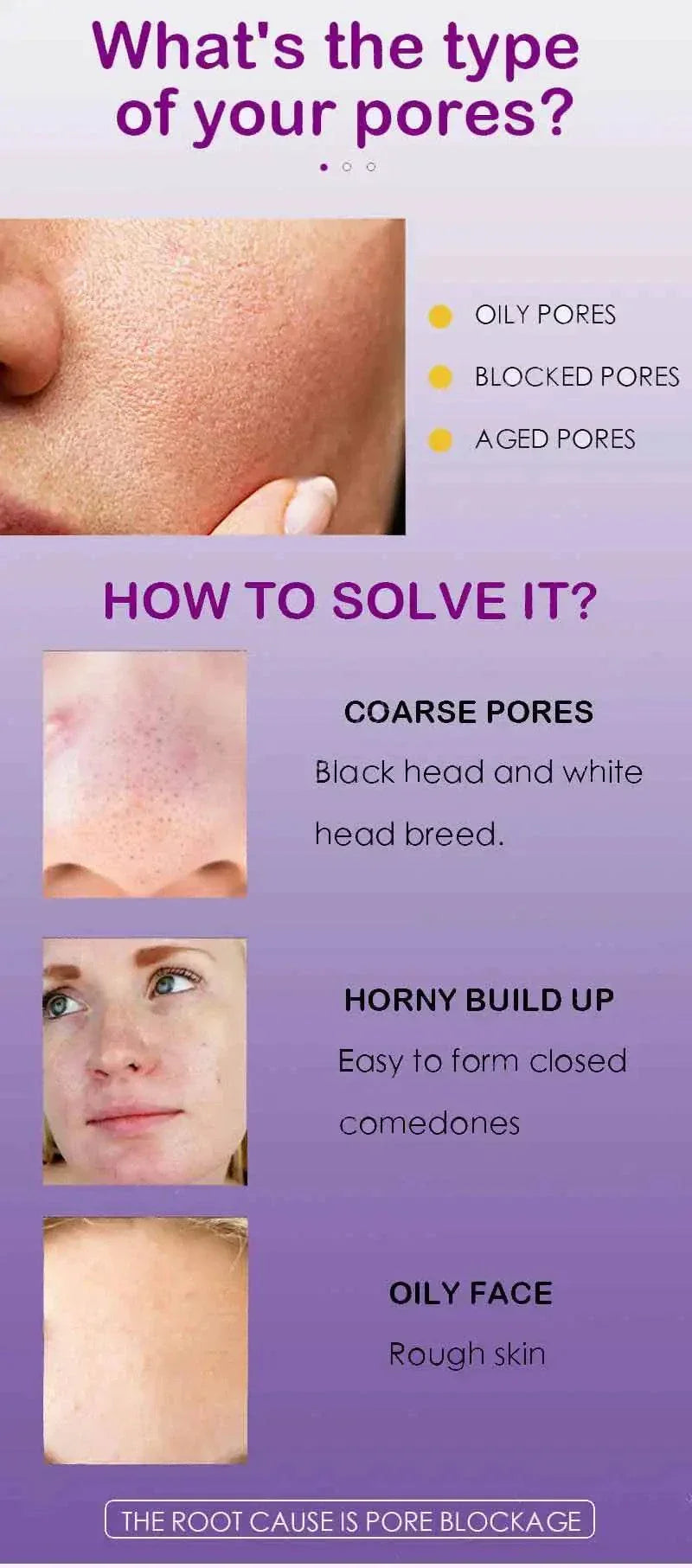 Pore shrinking serum infographic showing types of pores and solutions for oily pores, blocked pores, aged pores, coarse pores, comedones, and oily face.